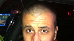 A photo posted online Monday, December 3, shows George Zimmerman with blood on his nose and lips. His attorneys say it was taken the night unarmed teen Trayvon Martin was killed in Sanford, Florida. Zimmerman, 28, faces second-degree murder charges in the death of Martin in Sanford, Florida, on February 26, 2012. Other evidence photos were released earlier this year: 
