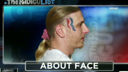 ac ridiculist face tattoo to be removed_00022817