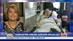 exp erin aimee copeland survivor of flesh eating disease speaks out_00003626