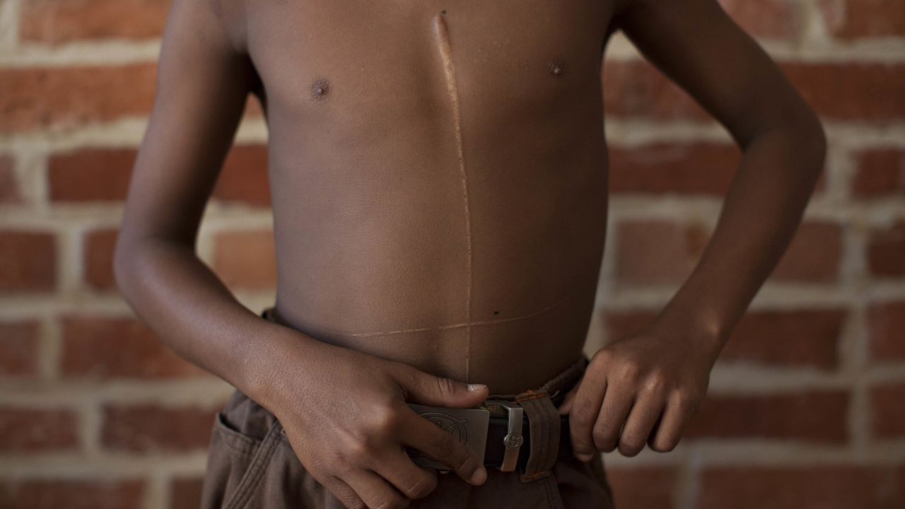 13 yo boys nude 