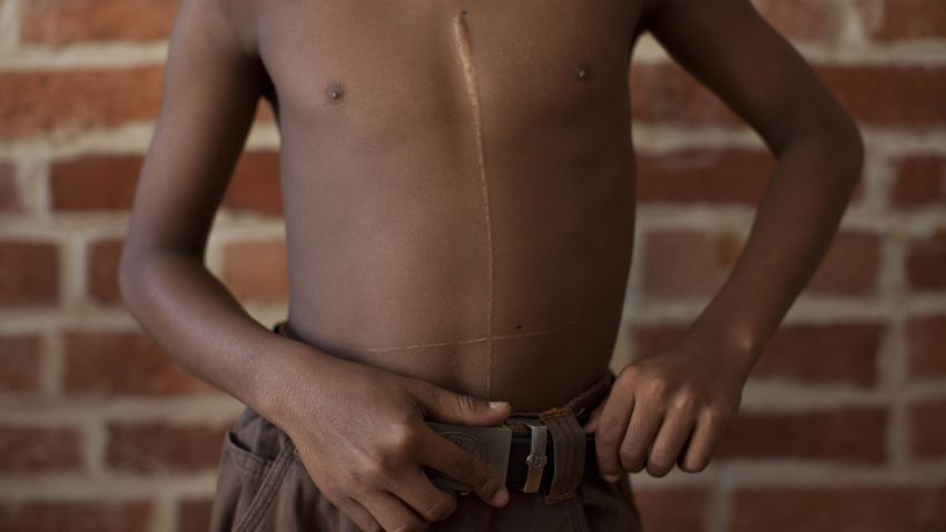 At age 7, the boy was attacked by four men. They bound his hands and feet and cracked open his head with a brick. They slashed his throat and sliced his chest and belly in an upside down cross.