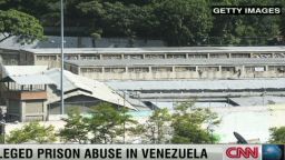 pkg romo venezuela prison abuse_00001208