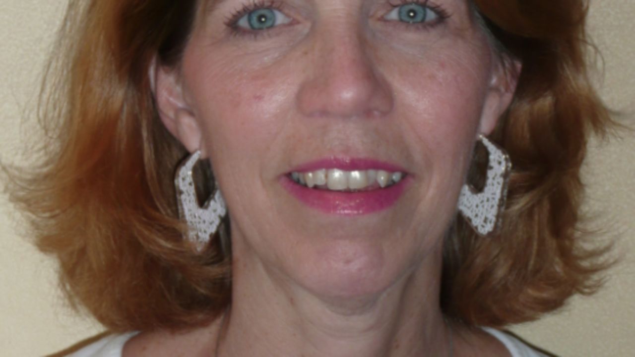 Lori Haas