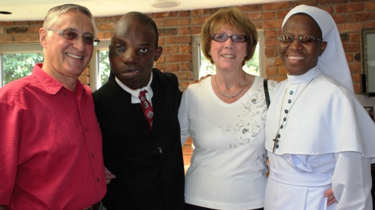 Victor Chukwueke (second from the left) is shown with his surgeon, Dr. Ian Jackson, the doctor's wife and the nun who has cared for him since he came to the United States.