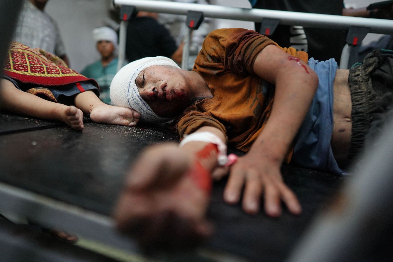 Palestinian children receive treatment at the Nasser Hospital in Khan Younis, Gaza, on Thursday, July 25. <a href="index.php?page=&url=https%3A%2F%2Fwww.cnn.com%2F2024%2F07%2F30%2Fmiddleeast%2Fkhan-younis-residents-return-intl%2Findex.html">The Israeli military has now withdrawn from eastern Khan Younis</a>, more than a week after an incursion and heavy bombardment killed dozens of Palestinians and forced thousands of others to flee. The Israeli military had issued an evacuation order in parts of Khan Younis on July 22, saying it was “about to forcefully operate against the terrorist organizations” that it said were firing rockets from neighborhoods south of the city.