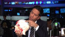 Hillary Clinton treated for blood clot in her head