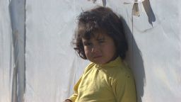 natpkg syria children scarred_00000903
