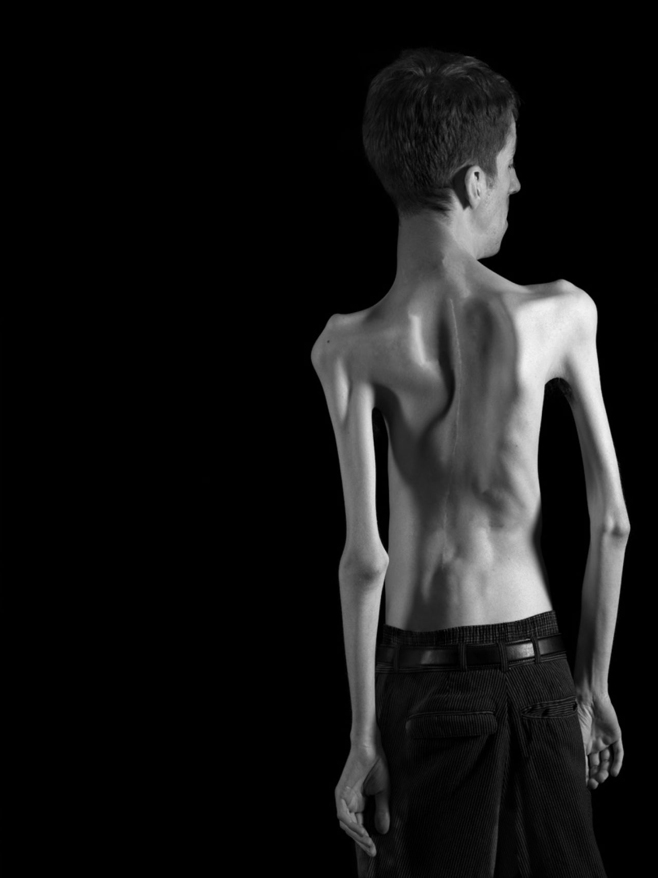In his photo project "Impaired Perceptions," Brian Steel fights ableism, a form of discrimination or prejudice against people with disabilities. "We have all felt like an outsider in some way, and in that way, we are all the same," says Steel. To see more of Steel's photos, <a href="http://www.briancharlessteelphotography.com/perceptions.html" target="_blank" target="_blank">click here</a>.