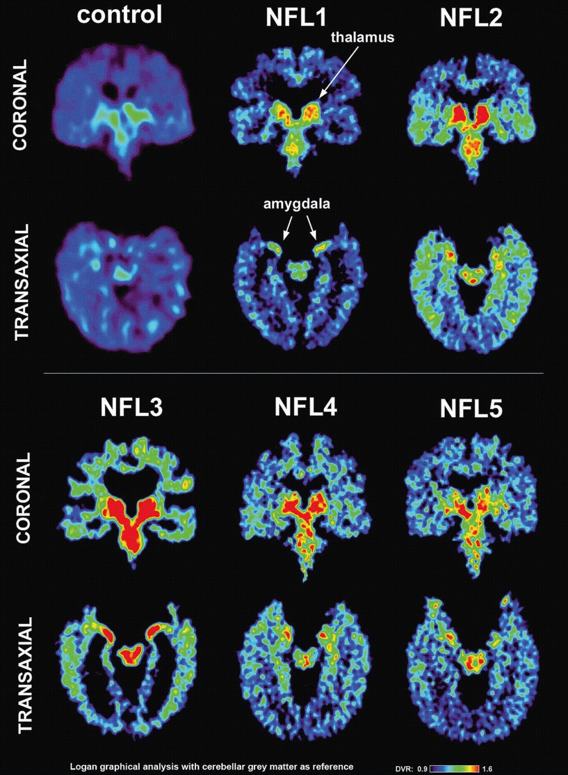 Players' brain scans 