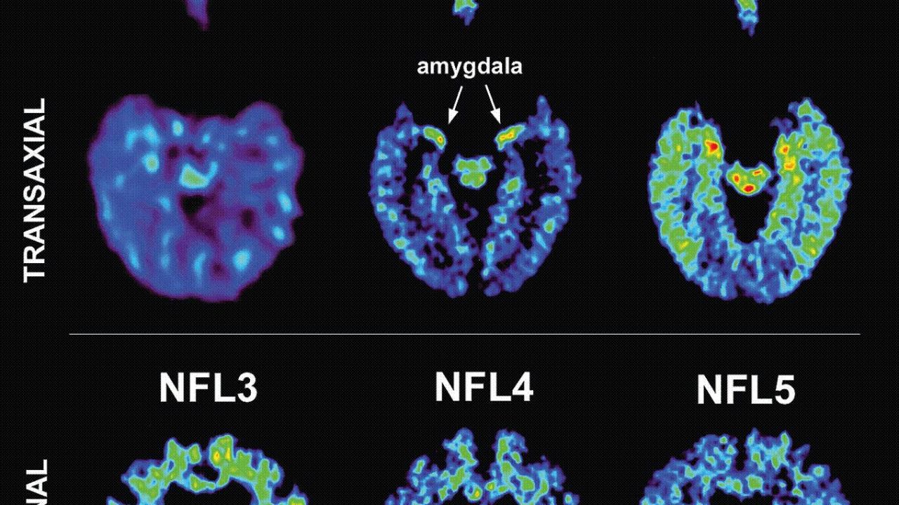Players' brain scans