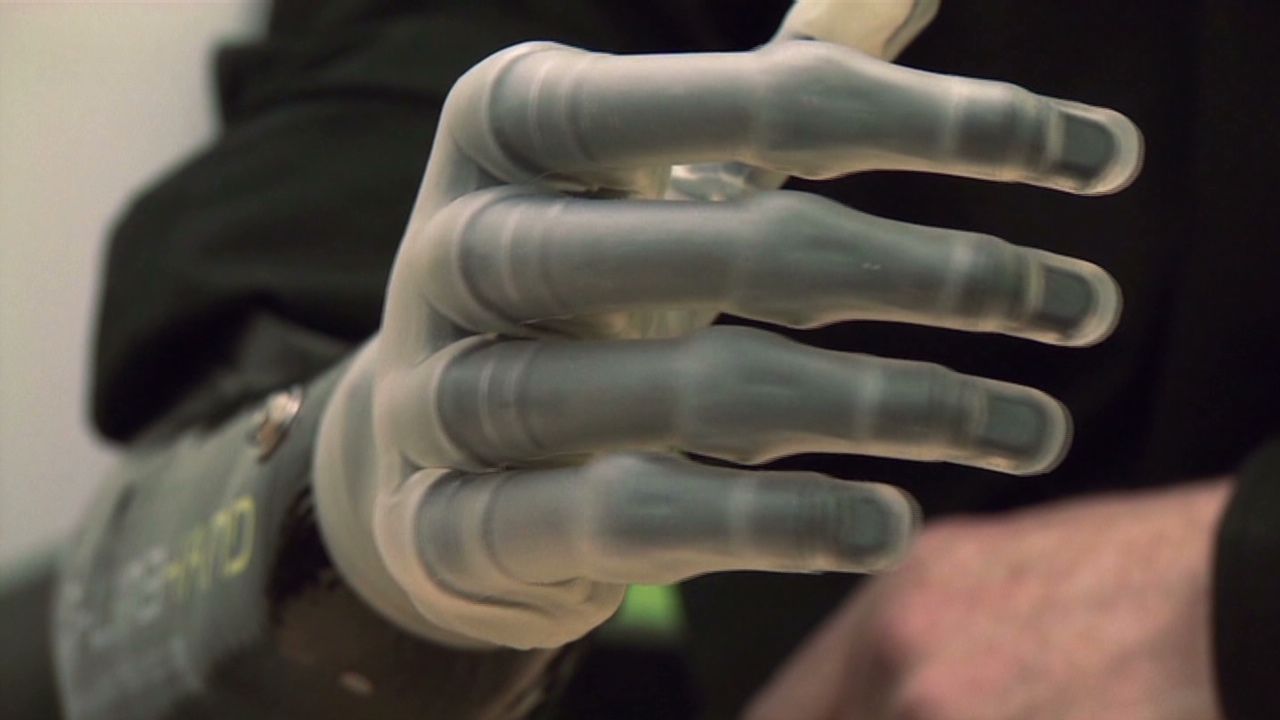 The bionic hand with the human touch