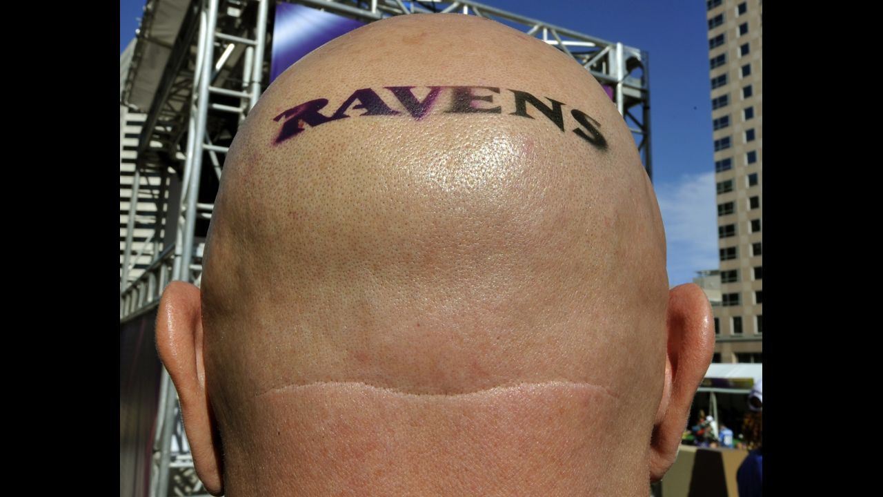 A Baltimore Ravens fan wears his heart on his scalp in New Orleans.