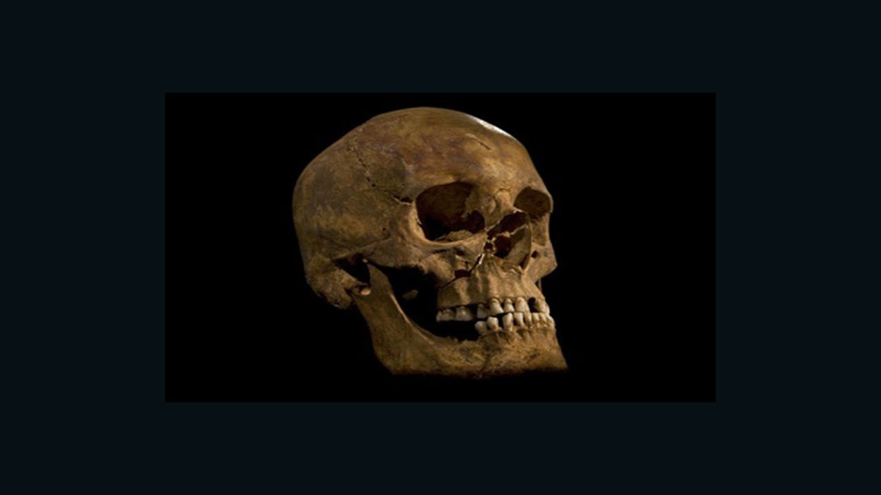 The skull of the skeleton found at the Grey Friars excavation in Leicester, potentially that of King Richard III.