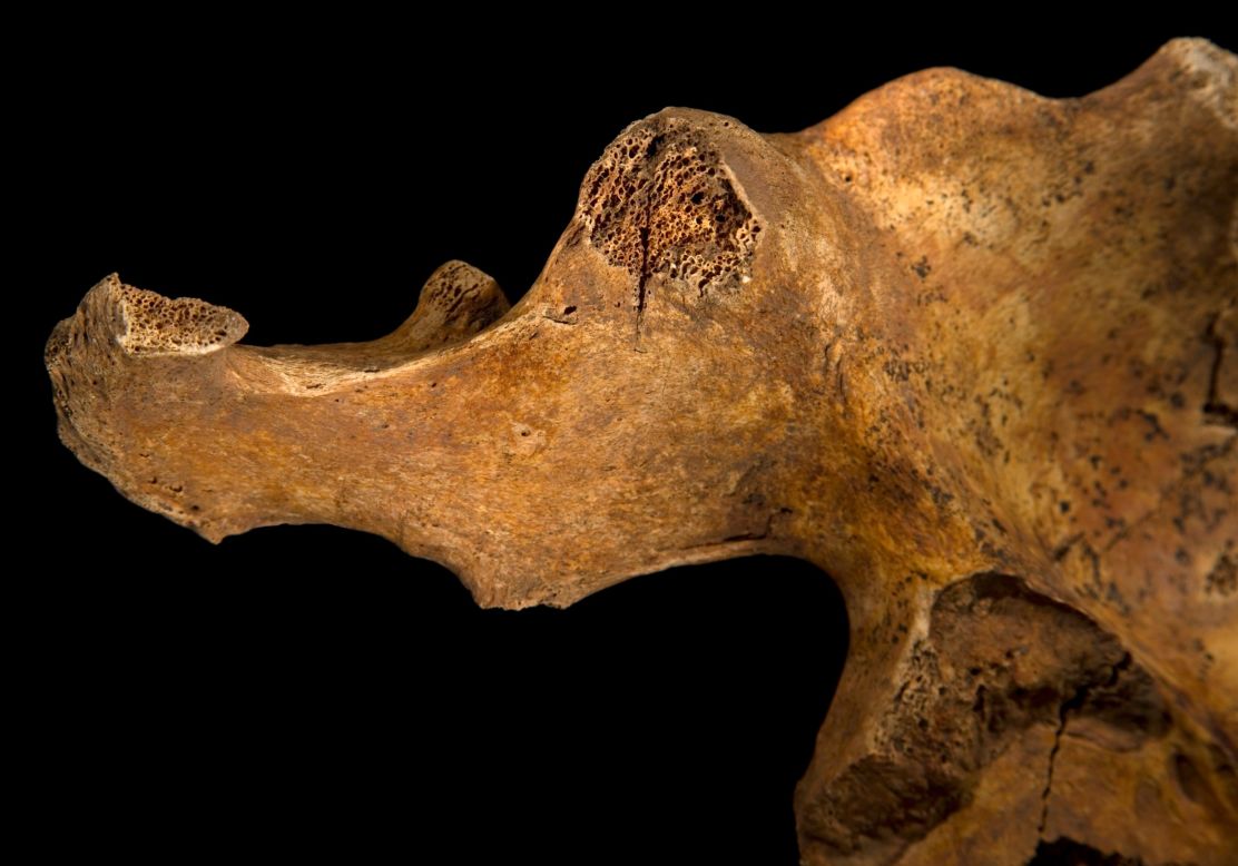 The image shows a blade wound to the pelvis, which has penetrated all the way through the bone.