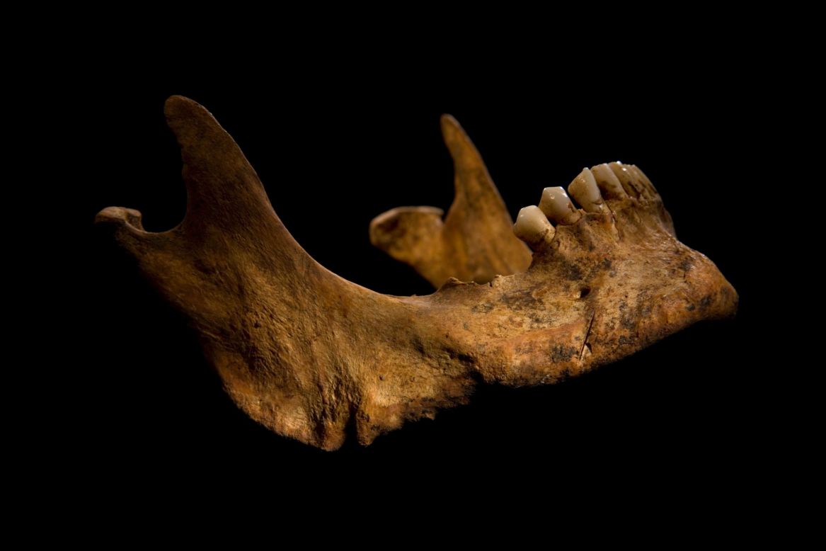 The lower jaw shows a cut mark caused by a knife or dagger. The archaeologists say the wounds to Richard's head could have been what killed him.