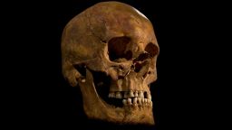 The skull of Richard III.