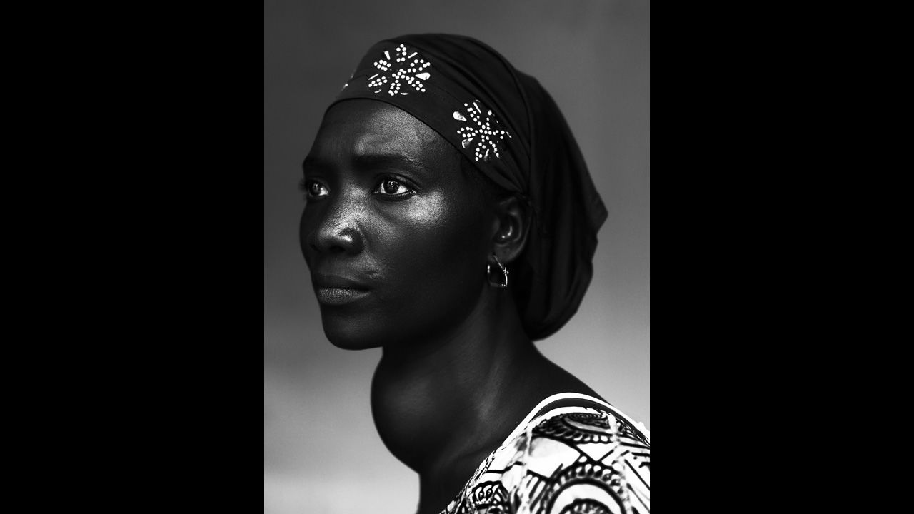 <strong>First prize people -- staged portraits stories: </strong>Makone Soumaoro, 30, who has a goiter, is photographed in Conakry, Guinea, on October 17, 2012. "I don't have pain, but I am worried that my neck swells that much," she told photographer Stephan Vanfleteren. "I hope it it is not a tumor because I am a housewife and my man and three children need me."