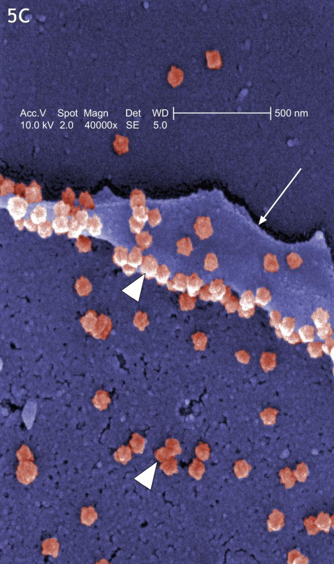 The SARS virus, a coronavirus like the common cold, is shown in pink in this electron micrograph image from the Centers for Disease Control.