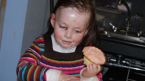A Child S Struggle Inspires Drive For Cure Cnn