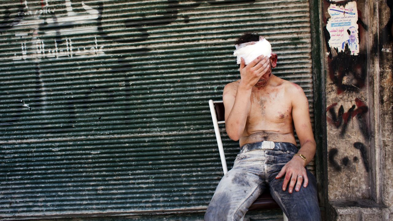 A Syrian man wounded by shelling sits on a chair outside a closed shop in Aleppo on September 4.
