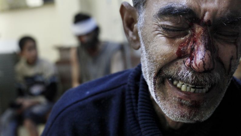 A man cries while being treated in a local hospital in a rebel-controlled area of Aleppo on October 31.