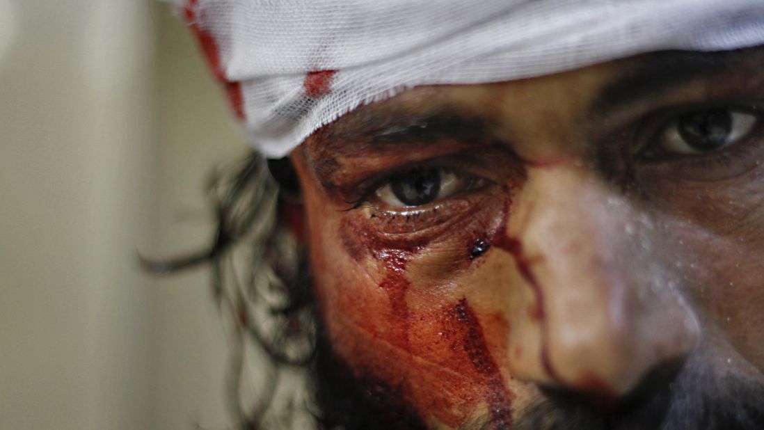 A man is treated for wounds after a government jet attacked the Karm al-Aser neighborhood in eastern Aleppo on October 31, 2012.