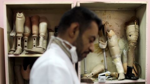A technician works on a prosthetic at a factory in Baghdad on December 13, 2011. Iraqis have faced a shortage of prosthetics due to a spike in war-related injuries over the years.