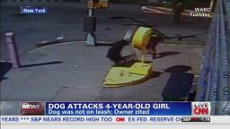 exp Dog attacks 4-year-old girl_00002001.jpg