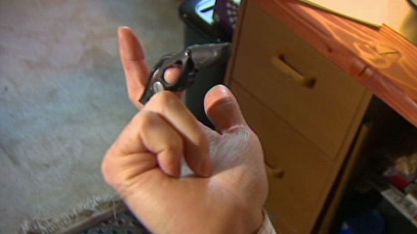 Amputee built finger from bike parts