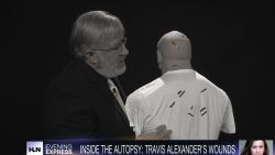 Examining Travis Alexander’s stab wounds CNN