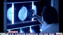 nr brooke cancer survival rates rise seg_00001509.jpg