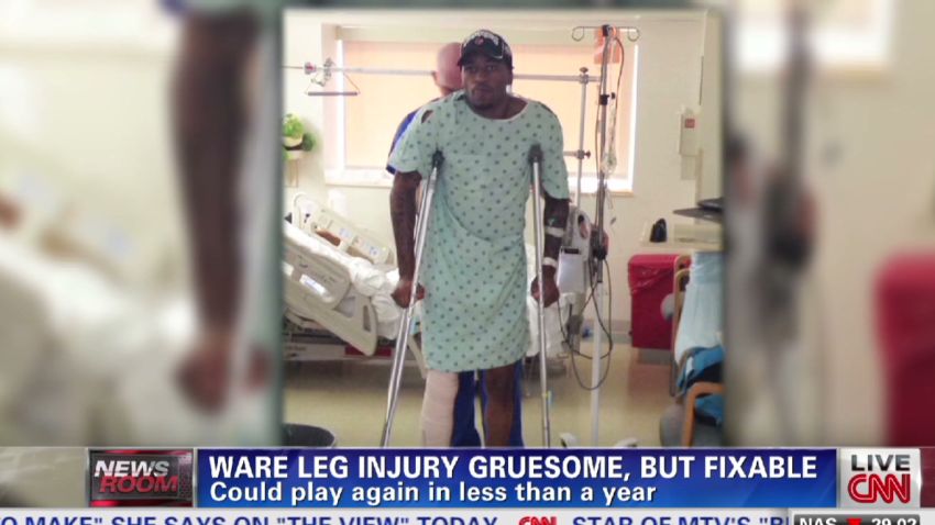 Louisville Cardinal Basketball Player Suffers Devastating Leg Injury Louisville Cardinal Basketball Player Suffers Devastating Leg Injury
