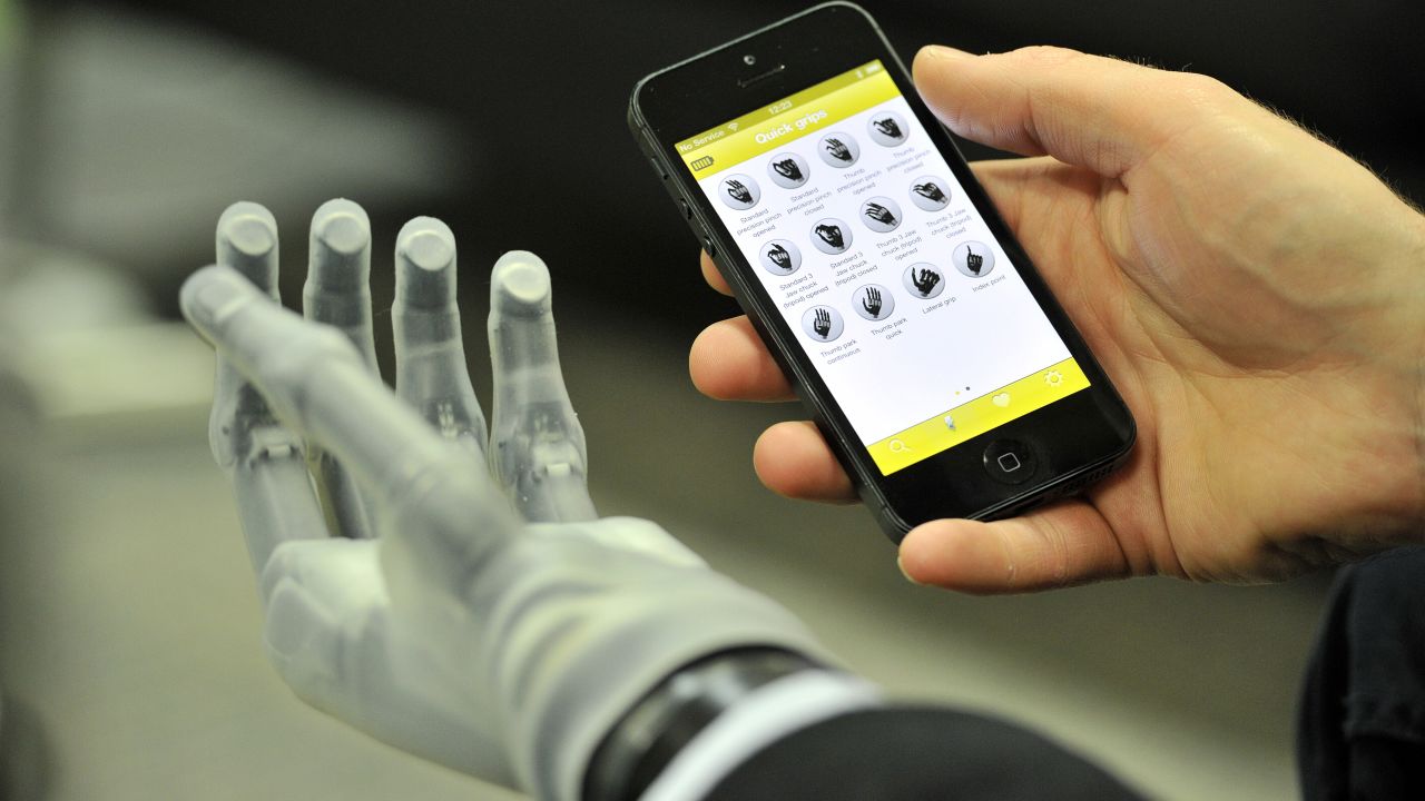 The i-limb ultra revolution hand, controllable by smartphone app. In time, will we  choose to have bionic enhancements?