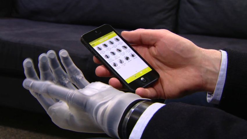 bionic hand iphone app