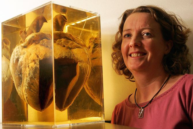 The Australian horse, who died from suspected poisoning by U.S. mobsters in 1932, also has his enormous 6.2-kilogram heart on display. "It was fortunate to posterity that he did die in America, as he was worked on by the top taxidermy firm in the world at that time -- the Jonas Brothers of New York," said Michael Reason, curator of the Phar Lap exhibition.