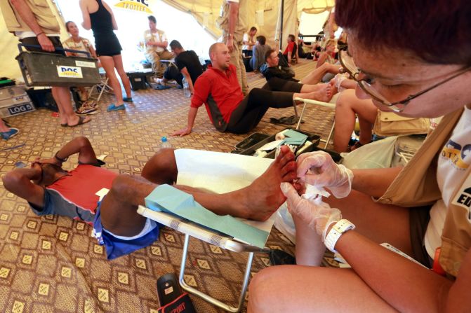 Competitors receive treatment for their feet Thursday during the two-day 75.7 kilometer stage.