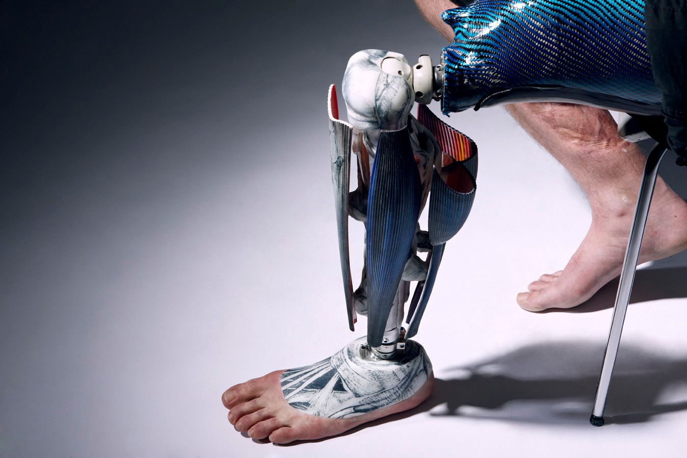 Snake arms and crystal legs: Artificial limbs push boundaries of