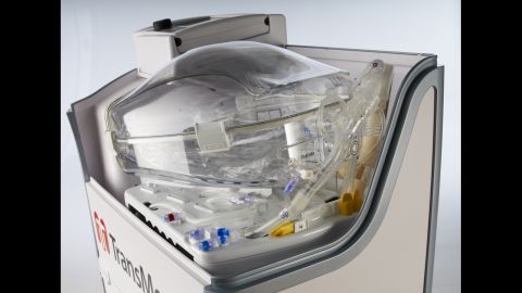 The TransMedics Organ Care System is a portable device that allows doctors to keep organs "alive" during transport. 