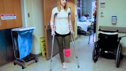 Adrianne Haslet-Davis, a dance instructor, walks in her hospital room at Boston Medical Center, April 22, 2013. She and her husband were among the more than 170 victims injured at the Boston Marathon last Monday. Surgeons were forced to amputate part of her leg, five inches below her left knee.