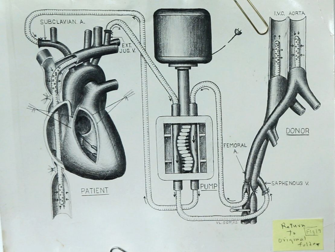 Vincent Gott's knack for illustrating heart procedures got him noticed by a preeminent heart surgeons.  
