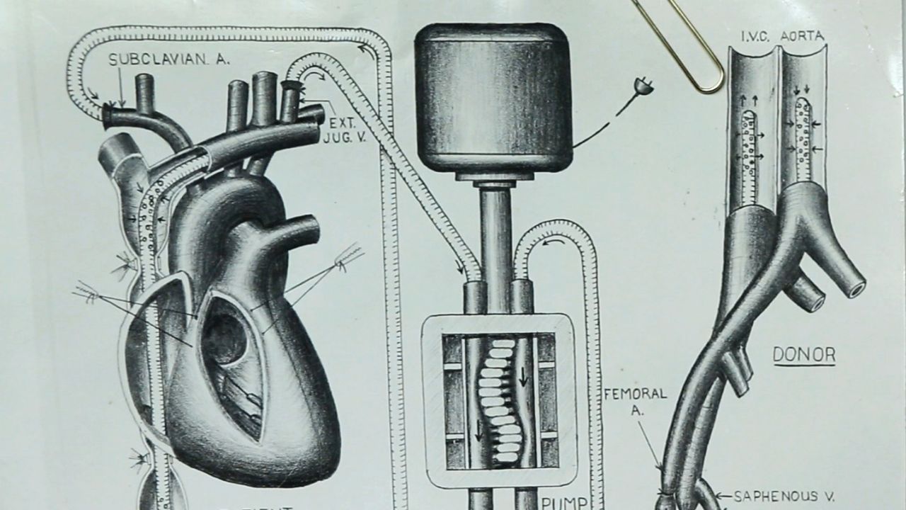 Vincent Gott's knack for illustrating heart procedures got him noticed by a preeminent heart surgeons.