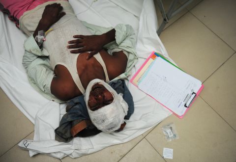 An injured Bangladeshi lies on the hospital floor on April 24.