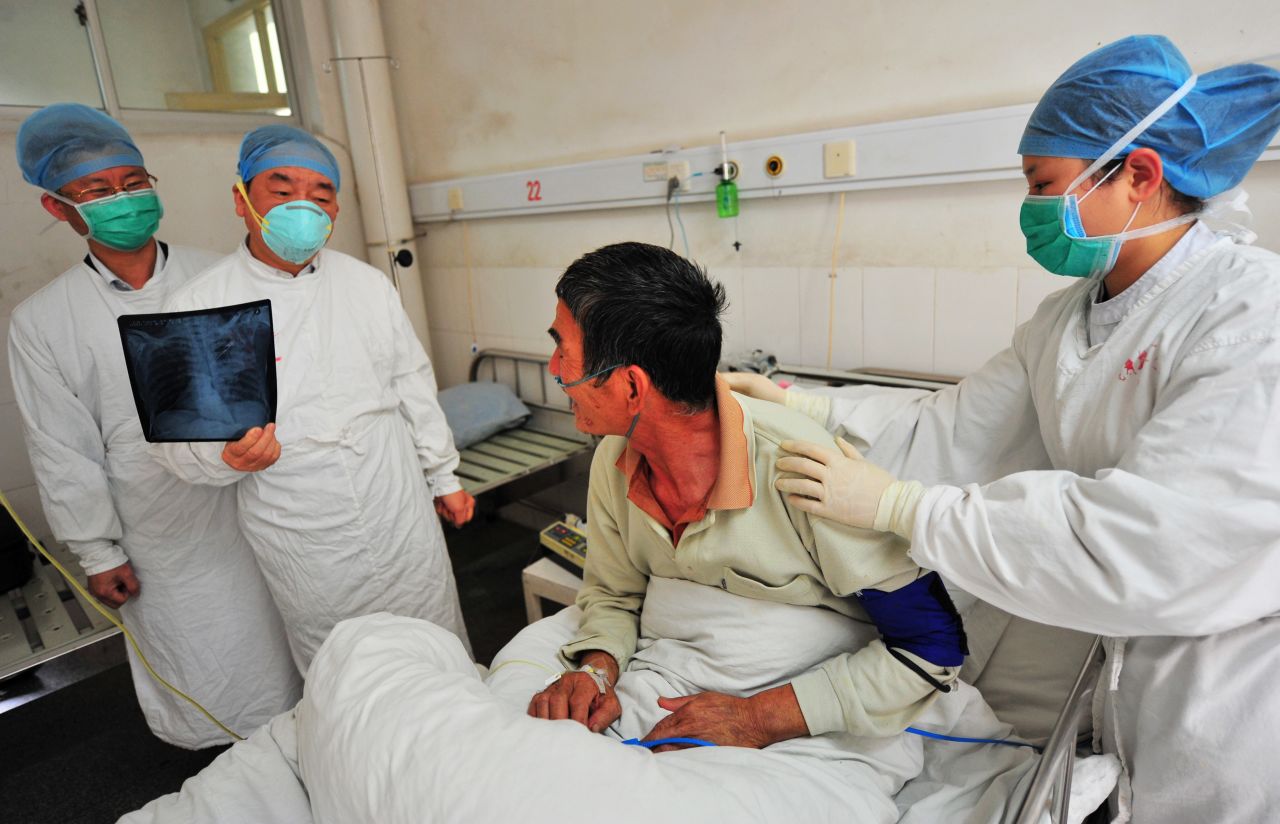 Doctors hold a consultation on the treatment for a patient surnamed Luo, the province's first human case of H7N9 avian influenza, at the No. 2 Hospital in Longyan City, in southeast China's Fujian Province, on April 27. Luo, 65, a local resident, showed symptoms of repeated coughing, low fever and a tight chest on April 18. Luo tested positive for the H7N9 virus on Friday by the Chinese Center for Disease Control and Prevention. Thirty-seven people who have been in close contact with Luo have not shown any abnormal symptoms so far.