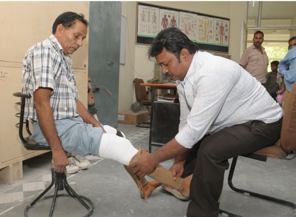 Indian prosthetics organization, BMVSS, say they can produce an artificial limb for as little as $45. This compares to upwards of $10,000 dollars for a similar procedure in the U.S. Thousands of Indian amputees who would otherwise be unable to afford expensive medical procedures have benefited from BMVSS and their "Jaipur Foot" program since it was established in 1975.