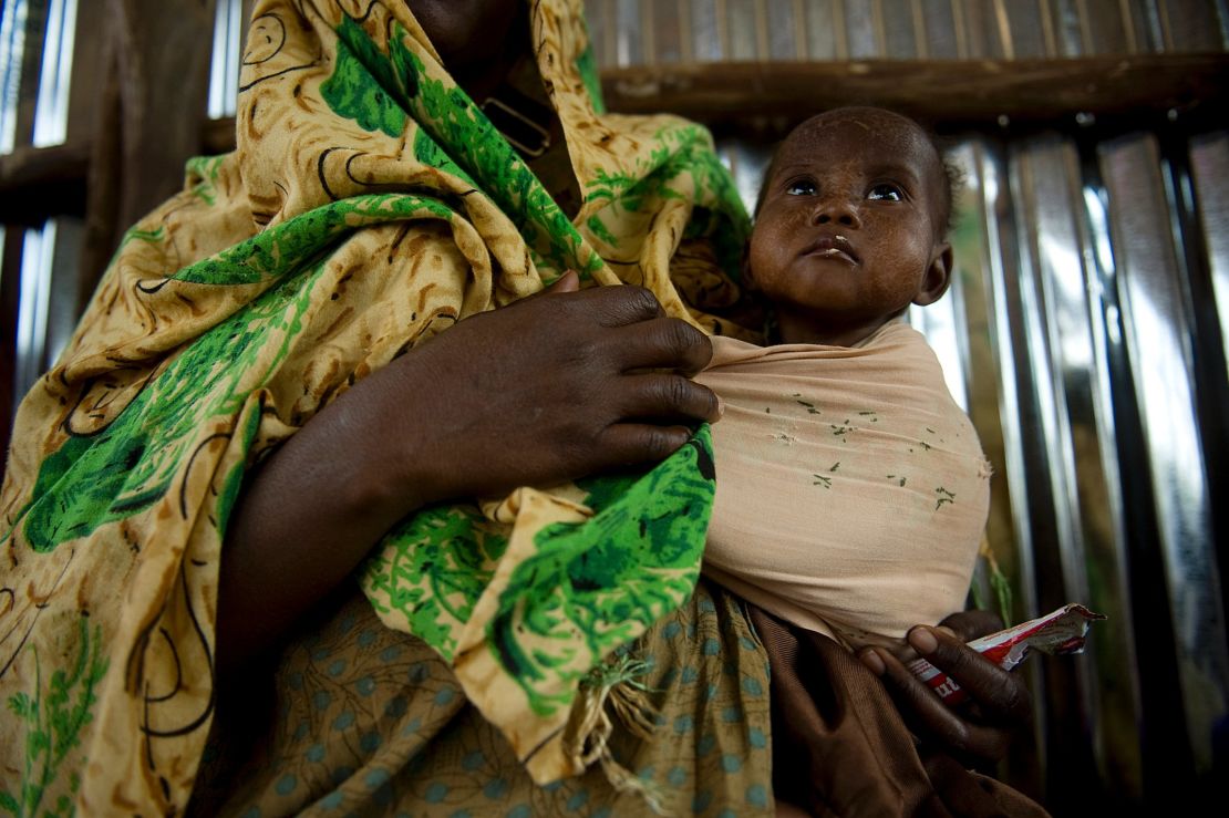 A mother holds her malnourished child at a feeding centre in Dollow, nothern Somalia. 