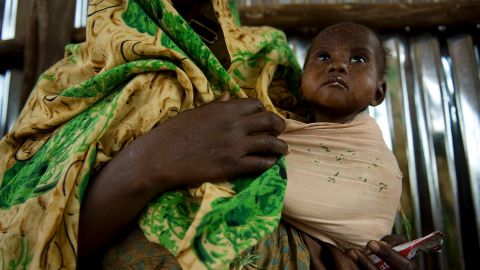 A mother holds her malnourished child at a feeding centre in Dollow, nothern Somalia. 