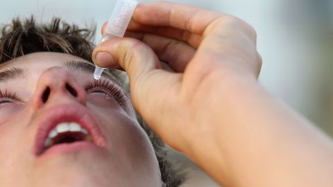 Between one-fourth and one-third of the U.S. population has allergic eye disease, experts say.