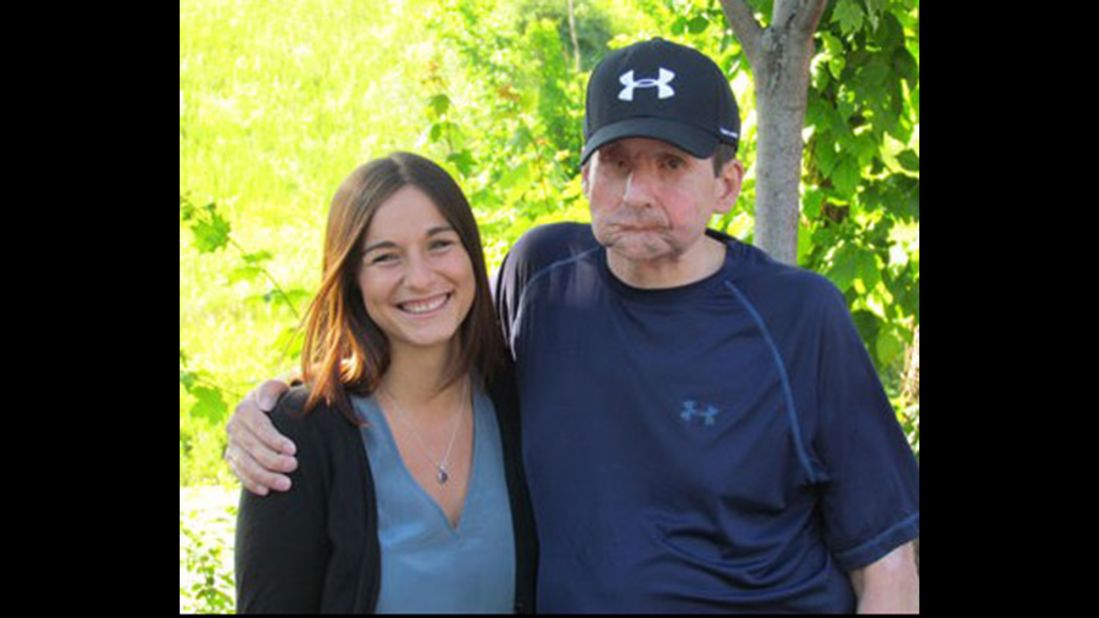 James Maki fell onto the electrified third rail at a Boston subway station on June 30, 2005, destroying the entire of the core of his face. Now after having a transplant, he's in the process of getting eight false teeth implanted in his mouth and a new set of dentures. He says he can't wait to eat a rib-eye steak.