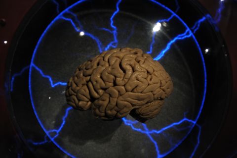 U.S. researchers are hopeful that human trials on a revolutionary memory implant will be fruitful. Scientists say that the implant could help people restore the memories of people who have had a stroke or suffered localized brain injury. 