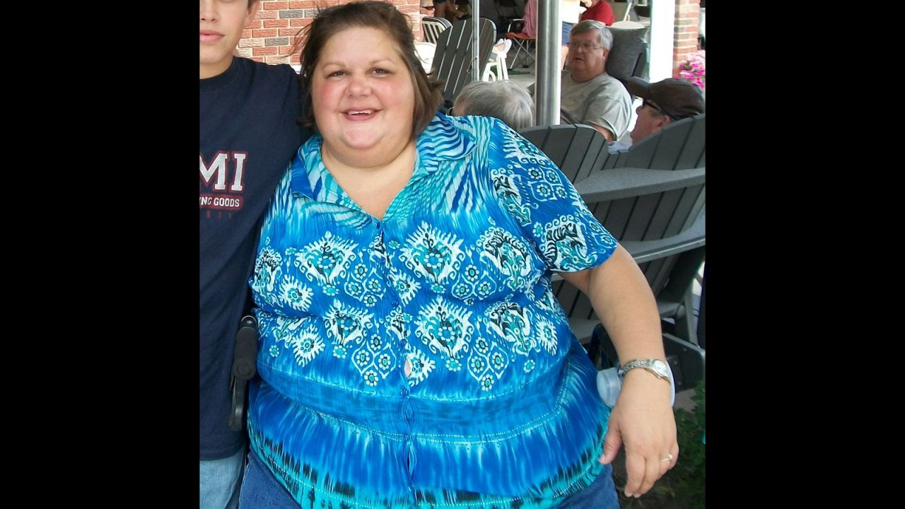 At her heaviest, Theresa Borawski weighed 428 pounds. She had a "sugar addiction" and was drinking up to 1,200 calories in soda a day. 